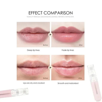 LipNourish · Micro-rodillo 2 en 1 con suero (105 agujas)