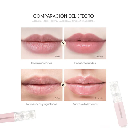Comparación de labios antes y después